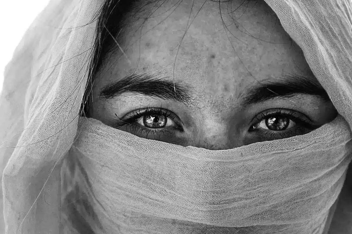 Close-up of a small swelling near the eyebrow on a clinic table with gauze